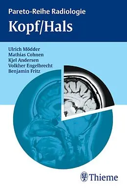 E-Book (pdf) Kopf/Hals von Ulrich Mödder