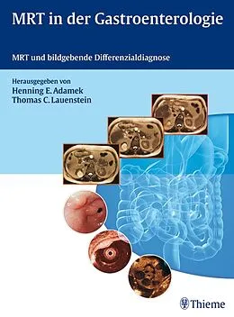 E-Book (pdf) MRT in der Gastroenterologie von Henning E. Adamek, Thomas C. Lauenstein