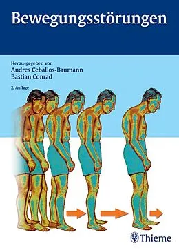 E-Book (pdf) Bewegungsstörungen von Andres O. Ceballos-Baumann, Bastian Conrad