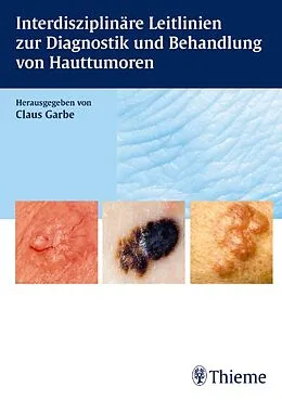 E-Book (pdf) Interdisziplinäre Leitlinien zur Diagnostik und Behandlung von Hauttumoren von Claus Garbe, Holger Reimann