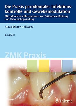 E-Book (pdf) Die Praxis parodontaler Infektionskontrolle und Gewebemodulation von Klaus-Dieter Hellwege