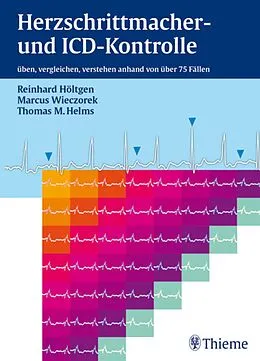 E-Book (pdf) Herzschrittmacher- und ICD-Kontrolle von Reinhard Höltgen, Marcus Wieczorek, Thomas M. Helms