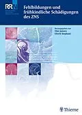 E-Book (pdf) Fehlbildungen und frühkindliche Schädigungen des ZNS von Fabian Härtling, Peter M. Wehmeier