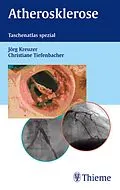 E-Book (pdf) Atherosklerose von Jörg Kreuzer, Christiane Tiefenbacher