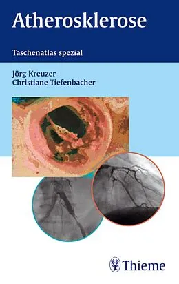E-Book (pdf) Atherosklerose von Jörg Kreuzer, Christiane Tiefenbacher