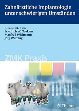 E-Book (pdf) Zahnärztliche Implantologie unter schwierigen Umständen von Gerhard Wanner