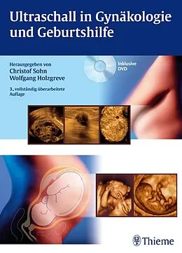 E-Book (pdf) Ultraschall in Gynäkologie und Geburtshilfe von Christof Sohn, Wolfgang Holzgreve