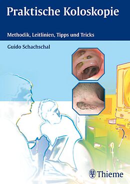 E-Book (pdf) Praktische Koloskopie von Guido Schachschal