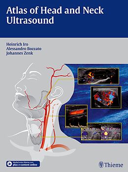 Livre Relié Atlas of Head and Neck Ultrasound de Heinrich Iro, Alessandro Bozzato, Johannes Zenk