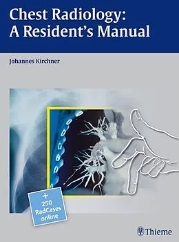 E-Book (pdf) Chest Radiology: A Resident's Manual von Johannes Kirchner