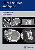 E-Book (pdf) CT of the Head and Spine von Norbert Hosten, Thomas Liebig
