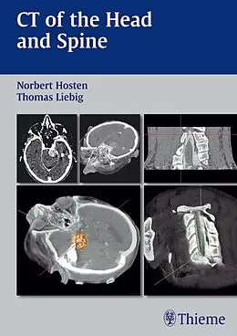 E-Book (pdf) CT of the Head and Spine von Norbert Hosten, Thomas Liebig