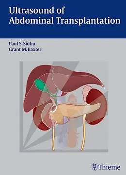 E-Book (pdf) Ultrasound of Abdominal Transplantation von Paul S. Sidhu, Grant M. Baxter