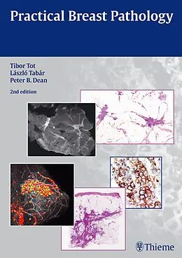 E-Book (pdf) Practical Breast Pathology von Tibor Tot, Laszlo Tabar, Peter B. Dean