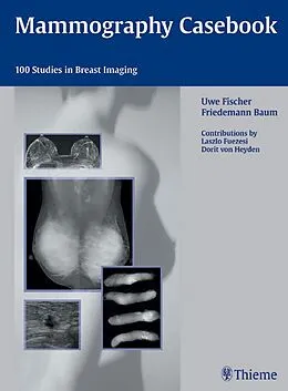 E-Book (pdf) Mammography Casebook von Uwe Fischer