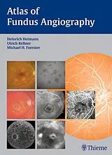 E-Book (pdf) Atlas of Fundus Angiography von 