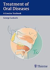 eBook (pdf) Treatment of Oral Diseases de George Laskaris