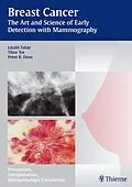E-Book (pdf) Breast Cancer - The Art and Science of Early Detection with Mammography von Laszlo Tabar, Tibor Tot, Peter B. Dean