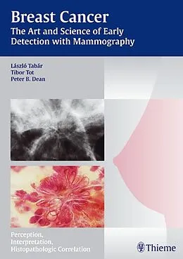 E-Book (pdf) Breast Cancer - The Art and Science of Early Detection with Mammography von Laszlo Tabar, Tibor Tot, Peter B. Dean