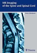E-Book (pdf) MR Imaging of the Spine and Spinal Cord von Detlev Uhlenbrock