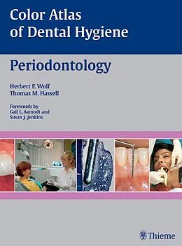 E-Book (pdf) Color Atlas of Dental Hygiene: Periodontology von Herbert F. Wolf, Thomas M. Hassell