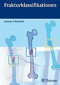 E-Book (pdf) Frakturklassifikationen von Sammy Alexander Baierlein