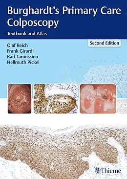 E-Book (pdf) Burghardt's Primary Care Colposcopy von Olaf Reich, Frank Girardi, Karl Tamussino