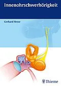 E-Book (pdf) Innenohrschwerhörigkeit von Gerhard Hesse