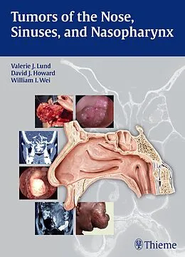 E-Book (pdf) Tumors of the Nose, Sinuses and Nasopharynx von Valerie J. Lund, David Howard, William I. Wei