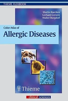 E-Book (pdf) Color Atlas of Allergic Diseases von Gerhard Grevers, Walter Burgdorf, Martin Röcken