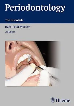 E-Book (pdf) Periodontology von Hans-Peter Müller
