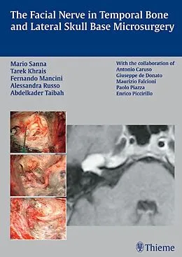 E-Book (pdf) The Facial Nerve in Temporal Bone and Lateral Skull Base Microsurgery von Tarek Khrais, Mario Sanna, Fernando Mancini