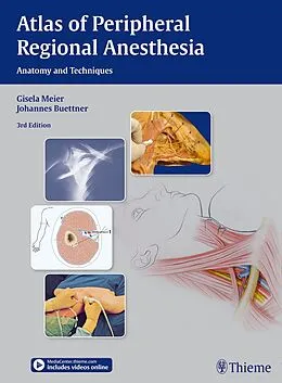 E-Book (pdf) Atlas of Peripheral Regional Anesthesia von Gisela Meier, Johannes Buettner