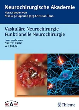 E-Book (pdf) Vaskuläre Neurochirurgie Funktionelle Neurochirurgie von Andreas Raabe, Veit Rohde