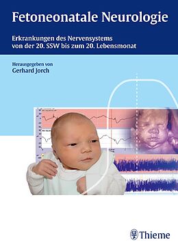 Fester Einband Fetoneonatale Neurologie von Gerhard Jorch