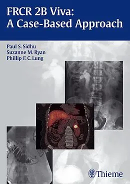 E-Book (pdf) FRCR 2B Viva: A Case-Based Approach von Paul S. Sidhu, Suzanne Ryan, Phillip F. C. Lung
