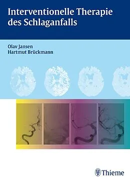 E-Book (pdf) Interventionelle Therapie des Schlaganfalls von Olav Jansen, Hartmut Brückmann