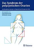 E-Book (pdf) Das Syndrom der polyzystischen Ovarien von Christoph Keck, Wilhelm Krone