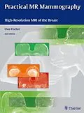 E-Book (pdf) Practical MR Mammography von Uwe Fischer
