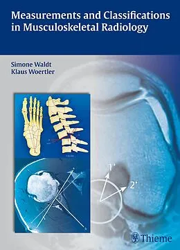 E-Book (pdf) Measurements and Classifications in Musculoskeletal Radiology von Simone Waldt, Klaus Wörtler
