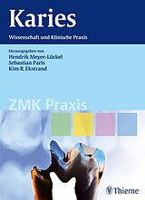 E-Book (pdf) Karies von Hendrik Meyer-Lückel, Sebastian Paris, Kim Ekstrand