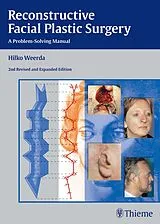E-Book (pdf) Reconstructive Facial Plastic Surgery von Hilko Weerda