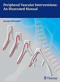 E-Book (pdf) Peripheral Vascular Interventions: An Illustrated Manual von Jürgen Schröder