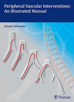 E-Book (pdf) Peripheral Vascular Interventions: An Illustrated Manual von Jürgen Schröder