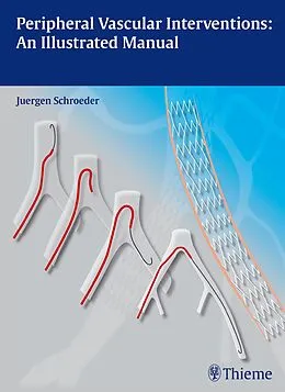 E-Book (pdf) Peripheral Vascular Interventions: An Illustrated Manual von Jürgen Schröder