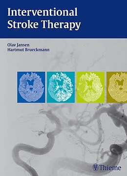 E-Book (pdf) Interventional Stroke Therapy von Olav Jansen, Hartmut Brückmann