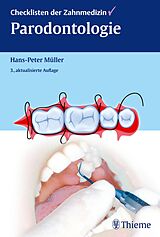 E-Book (pdf) Checklisten der Zahnmedizin Parodontologie von Hans-Peter Müller