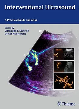 E-Book (pdf) Interventional Ultrasound von Dieter Nürnberg, Christoph Frank Dietrich