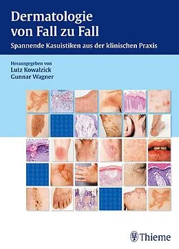 E-Book (pdf) Dermatologie von Fall zu Fall von Lutz Kowalzick, Gunnar Wagner