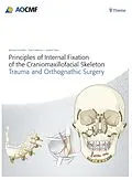 E-Book (pdf) Principles of Internal Fixation of the Craniomaxillofacial Skeleton von Joachim Prein, Michael Ehrenfeld, Paul N. Manson